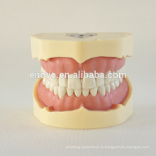 Modèle d&#39;étude dentaire de dents de vis de type de BF 13005, costume de dents de rechange pour la mâchoire de Frasaco